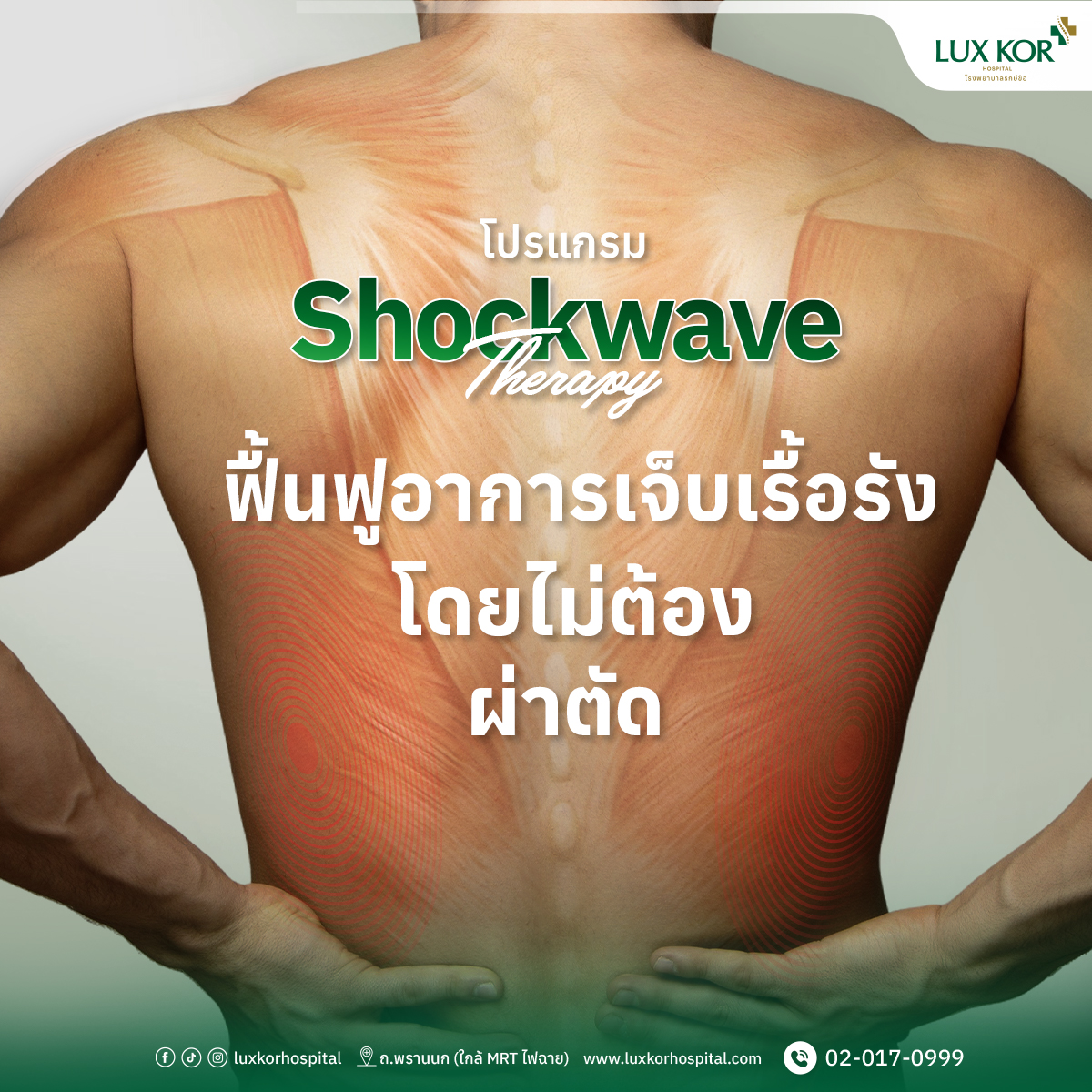 การทำ Shockwave Therapy ที่โรงพยาบาลรักษ์ข้อ