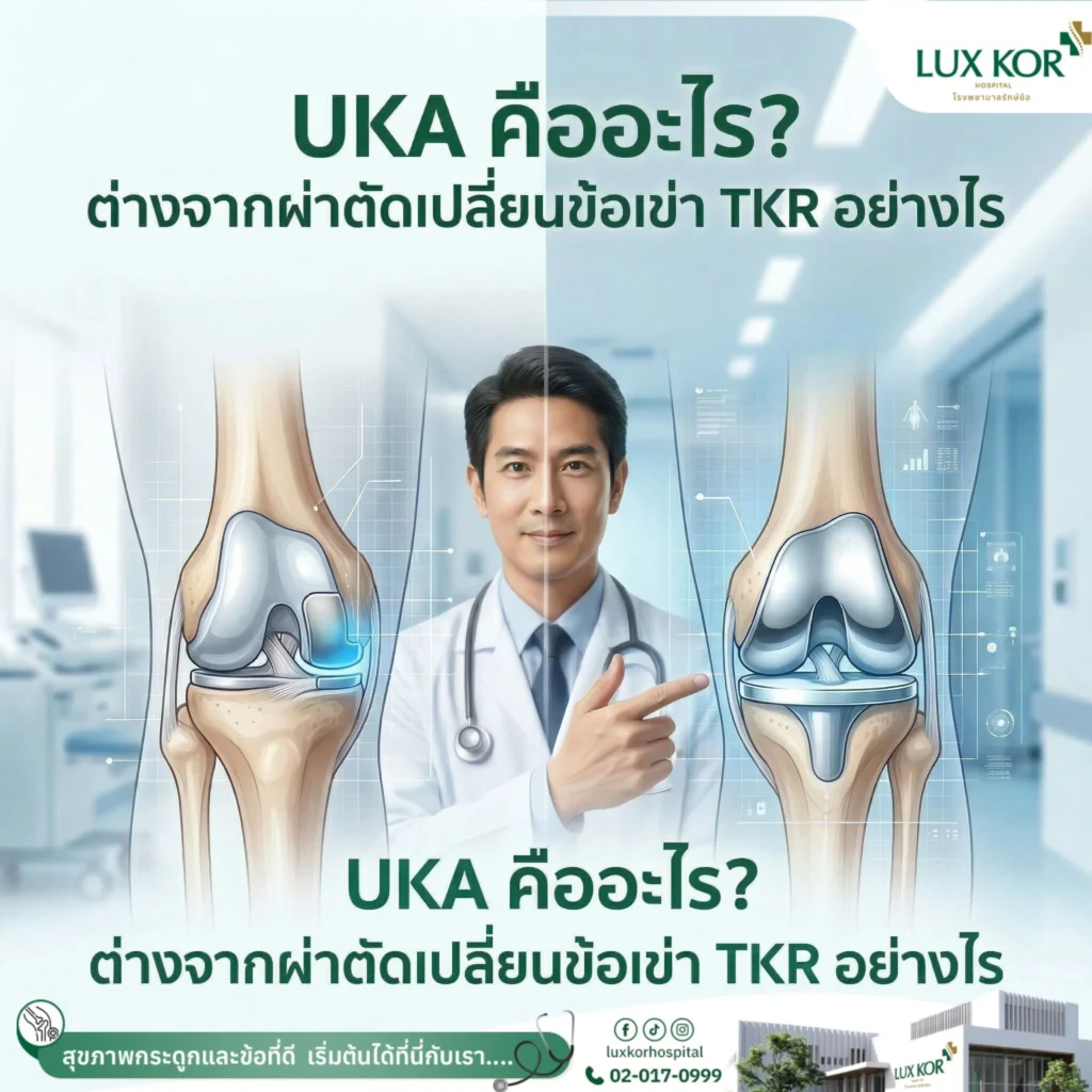 เปรียบเทียบการผ่าตัดเปลี่ยนข้อเข่าบางส่วนและแบบเต็ม