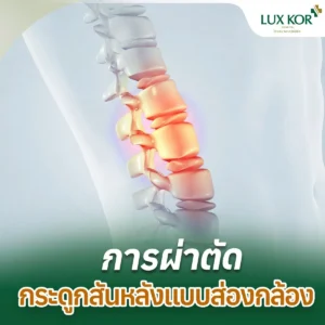 แพ็กเกจผ่าตัดกระดูกสันหลังแบบส่องกล้อง (Endoscopic Spine Surgery)