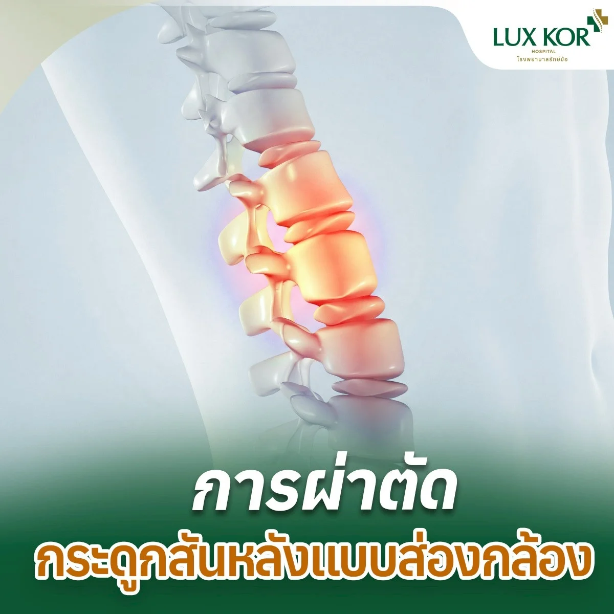แพ็กเกจผ่าตัดกระดูกสันหลังแบบส่องกล้อง (Endoscopic Spine Surgery)