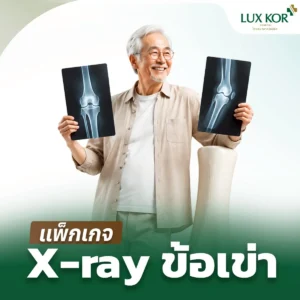 แพ็กเกจ X-ray ข้อเข่า