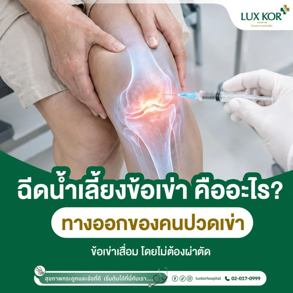การฉีดน้ำเลี้ยงข้อเข่าเพื่อรักษาภาวะข้อเข่าเสื่อมโดยแพทย์เฉพาะทาง โรงพยาบาลรักษ์ข้อ