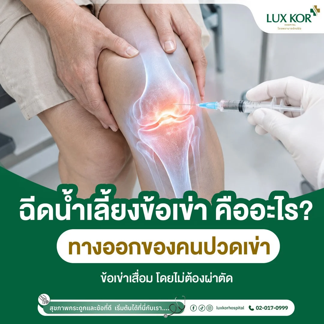 การฉีดน้ำเลี้ยงข้อเข่าเพื่อรักษาภาวะข้อเข่าเสื่อมโดยแพทย์เฉพาะทาง โรงพยาบาลรักษ์ข้อ
