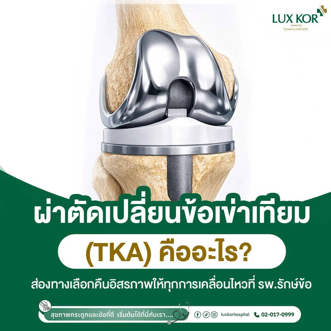 การผ่าตัดเปลี่ยนข้อเข่าเทียม TKA และการฟื้นฟูสมรรถภาพข้อเข่าโดยทีมแพทย์เฉพาะทาง โรงพยาบาลรักษ์ข้อ